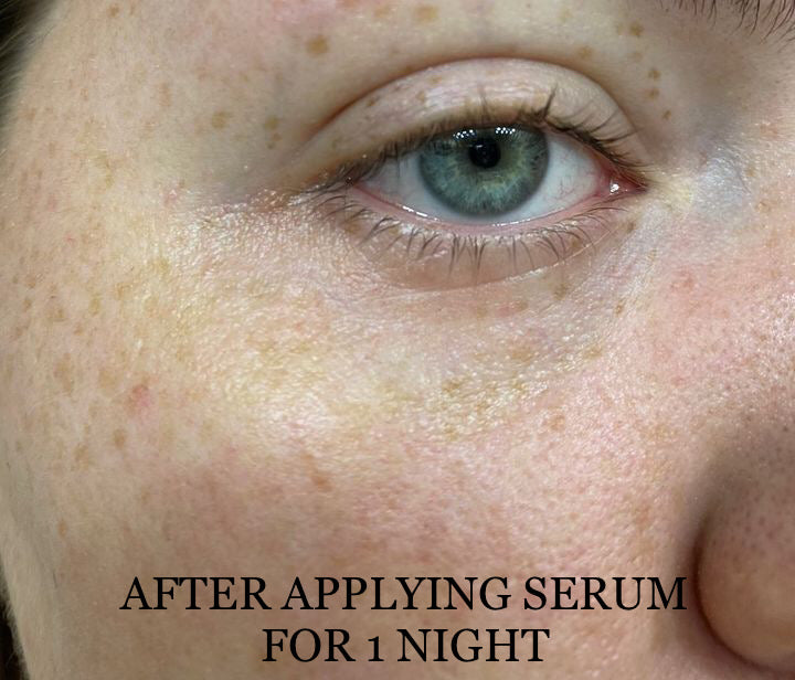 NEW Shwally Methylene Blue Repair Serums by Shwally