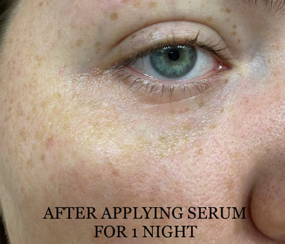 NEW Shwally Methylene Blue Repair Serums by Shwally