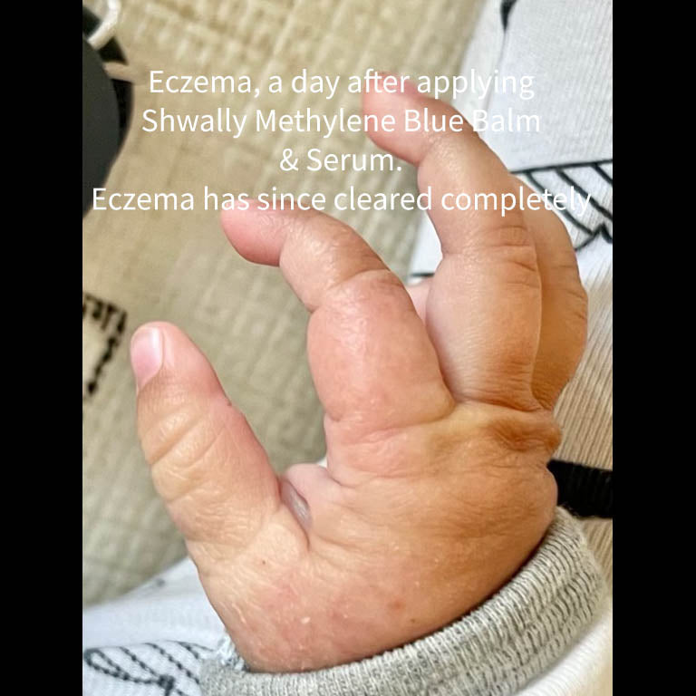 NEW Shwally Methylene Blue Repair Serums by Shwally