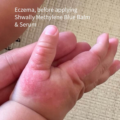 NEW Shwally Methylene Blue Repair Serums by Shwally